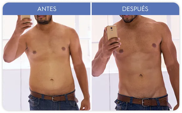 Imagen de galería