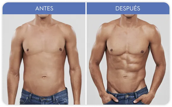 Imagen de galería