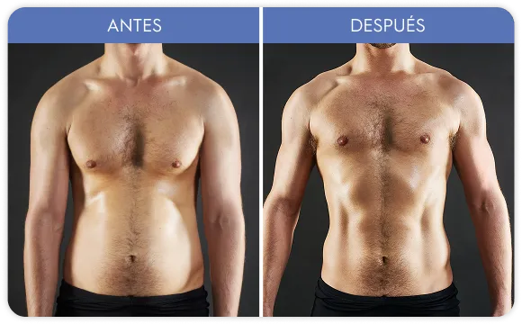 Imagen de galería
